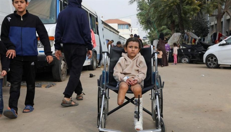 بترت أطرافهم.. ربع جرحى غزة على الأقل يعانون إصابات